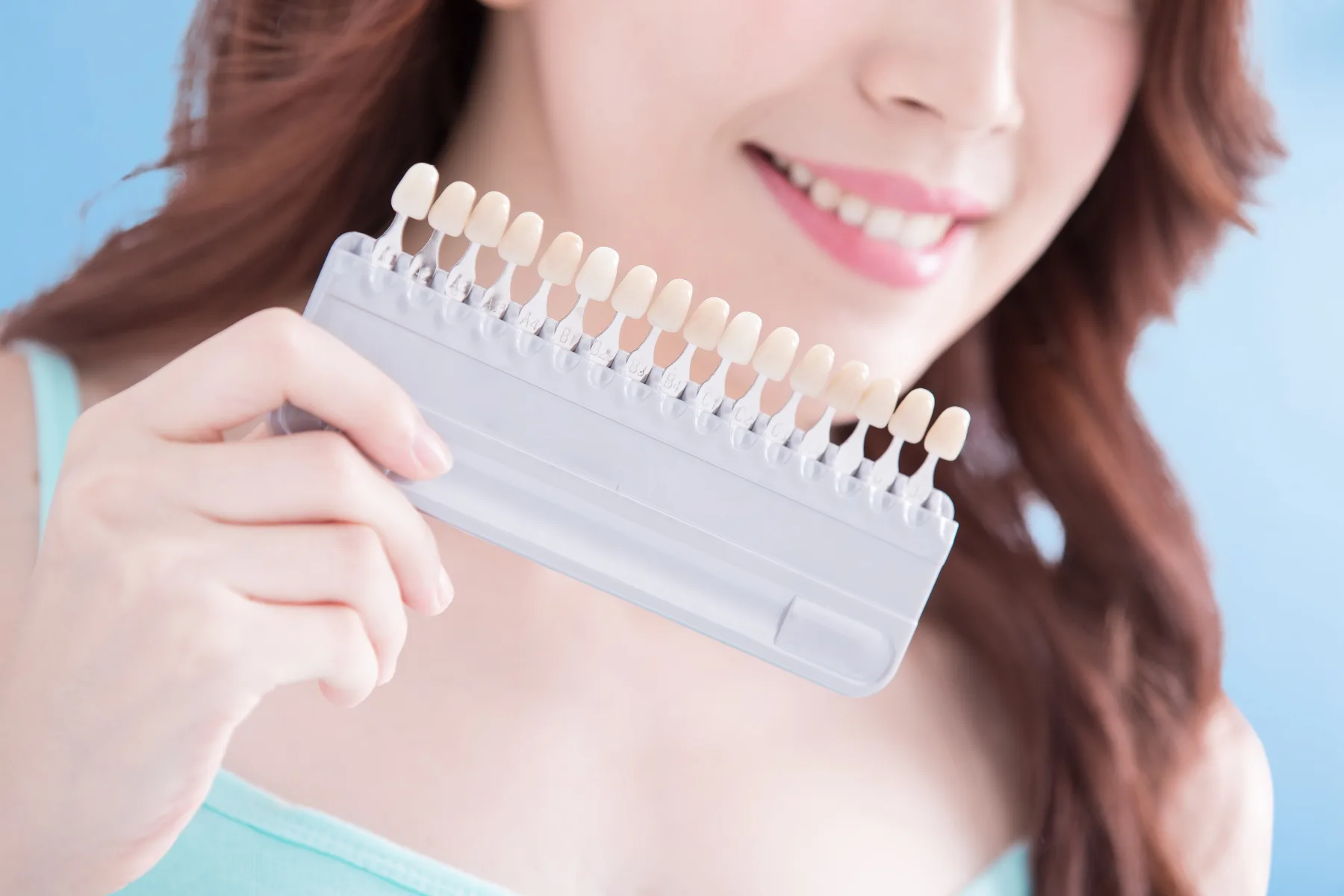 전문가 미백 — 치아에 미백 광조사기를 대고 진행하는 시술 장면